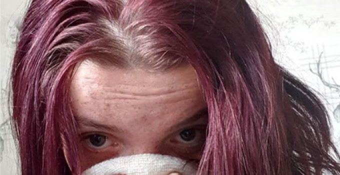 pelo desprende mal olor