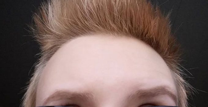 bleaching alternatives