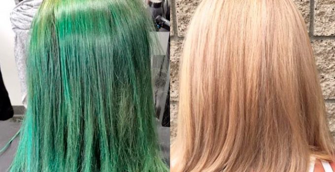 one bleaching session